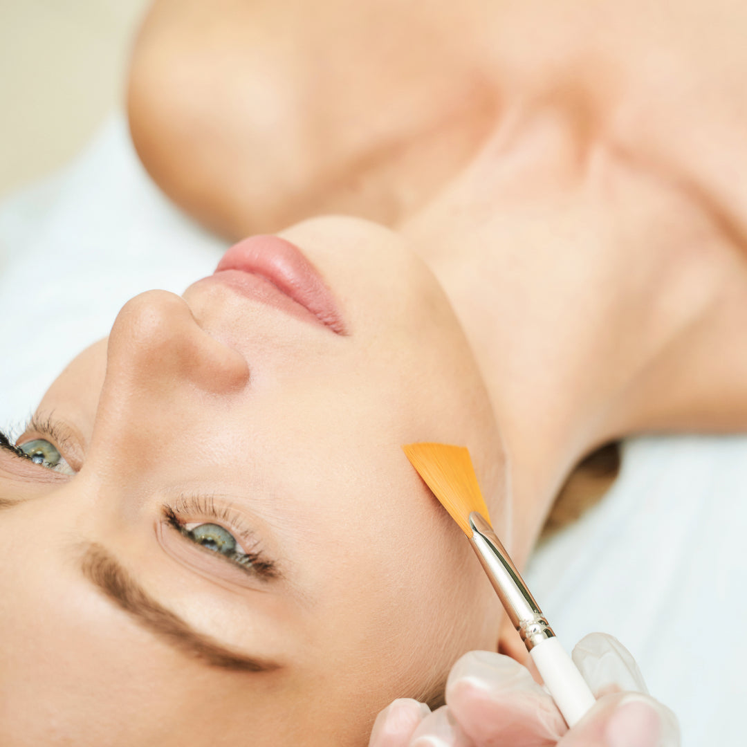 Glycolic Peel – SkinTrends