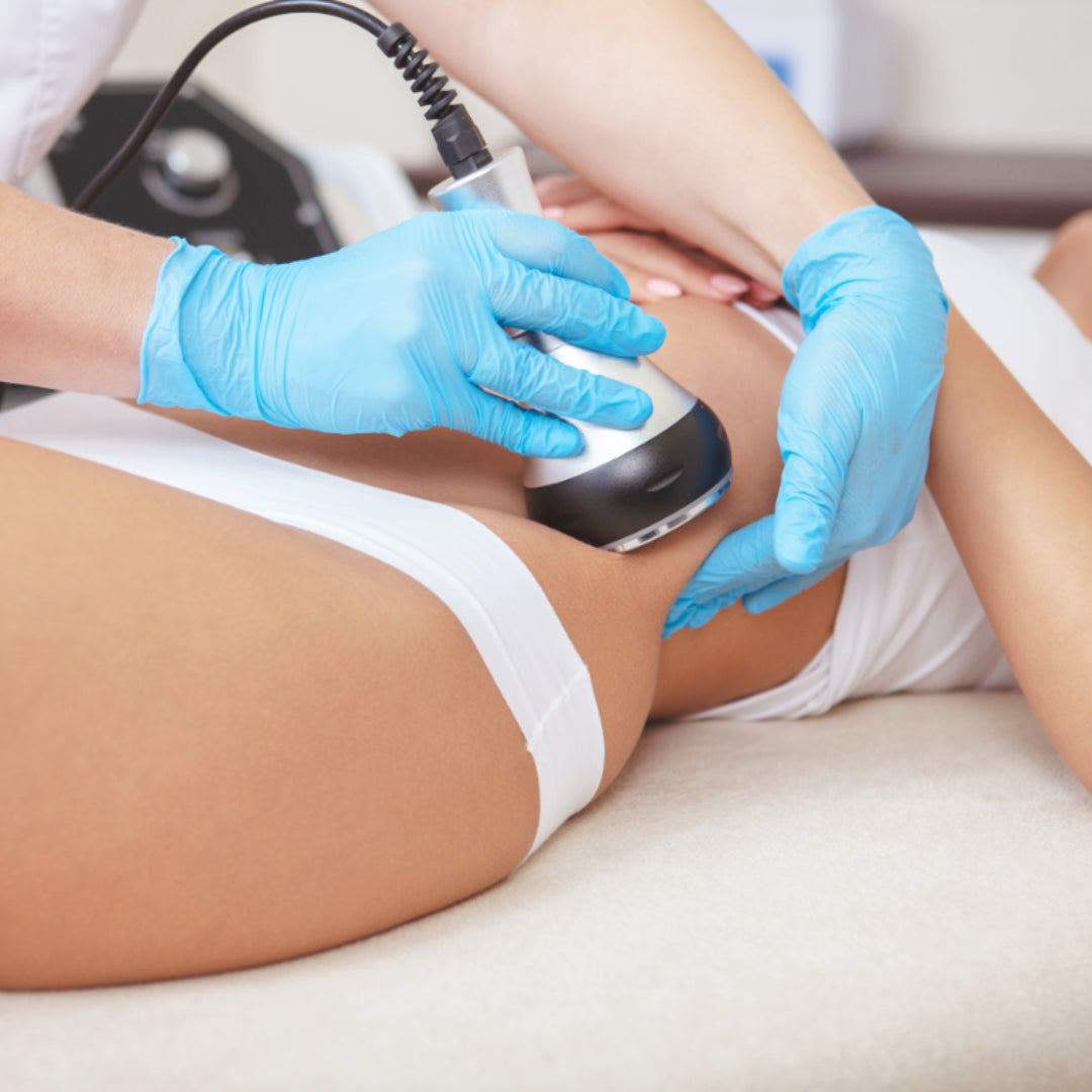 Ultralipo Fat Removal – SkinTrends